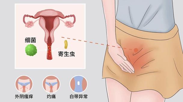 孕期下身瘙痒是正常现象吗?需要警惕哪些潜在问题?-第1张图片-郑州医学网 孕期下身瘙痒是正常现象吗?需要警惕哪些潜在问题?-第1张图片-郑州医学网