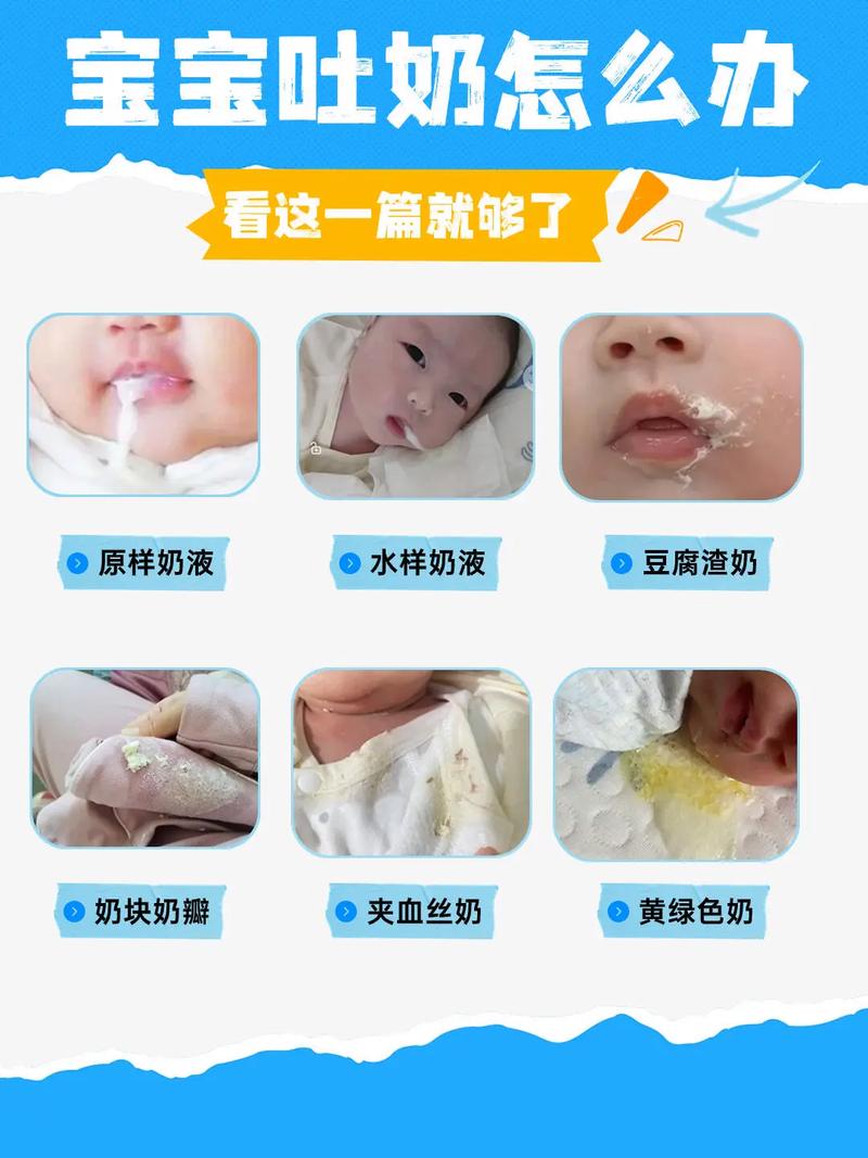 新生儿嘴吐沫是正常现象还是疾病信号？需警惕哪些潜在原因？-第3张图片-郑州医学网