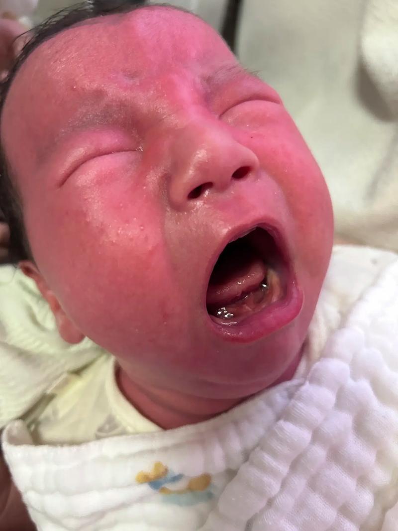 新生儿总是张嘴吐舌头是正常发育还是健康预警？-第1张图片-郑州医学网