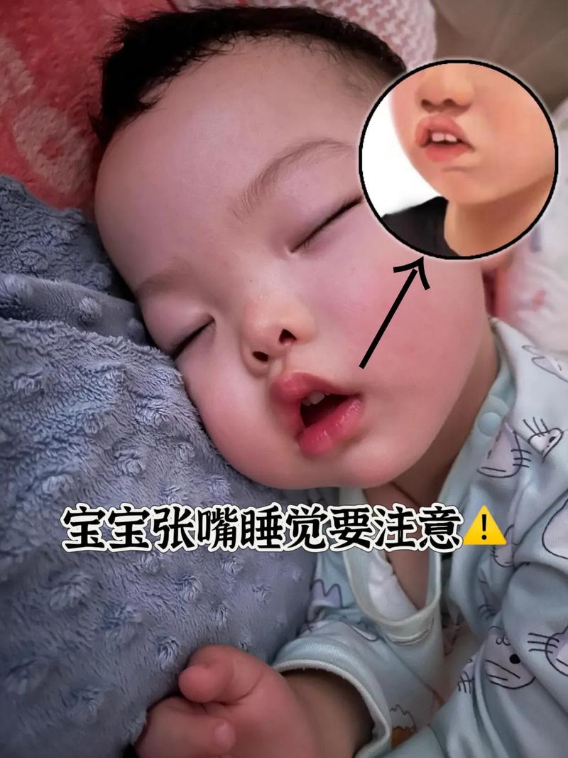 新生儿总是张嘴吐舌头是正常发育还是健康预警？-第2张图片-郑州医学网