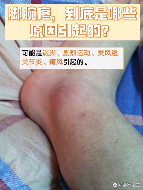 儿童脚腕疼是什么原因引起的？需要警惕哪些疾病或不良习惯？-第3张图片-郑州医学网