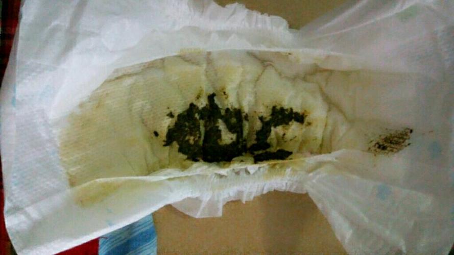 新生儿服用茵栀黄后出现嗜睡症状，是否属于药物不良反应？家长应如何应对？-第1张图片-郑州医学网