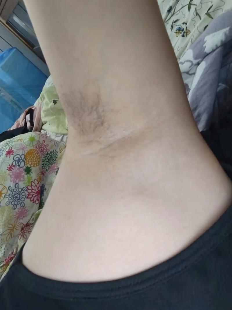 孕期腋下发黑真能判断生男生女?科学依据是什么?-第2张图片-郑州医学网 孕期腋下发黑真能判断生男生女?科学依据是什么?-第2张图片-郑州医学网