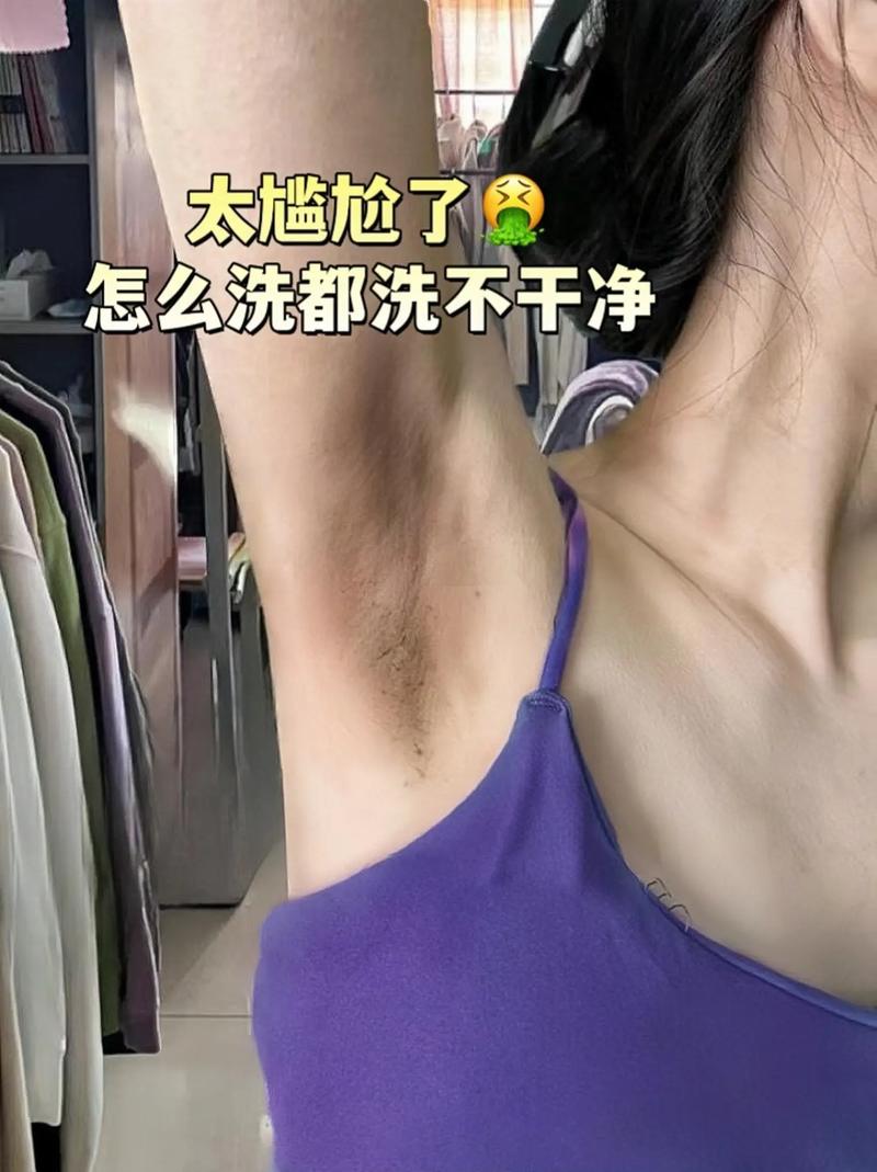 孕期腋下发黑真能判断生男生女?科学依据是什么?-第3张图片-郑州医学网 孕期腋下发黑真能判断生男生女?科学依据是什么?-第3张图片-郑州医学网
