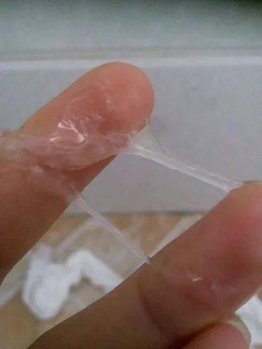 孕期下面流白色分泌物是正常现象还是异常信号？需要警惕哪些问题？-第1张图片-郑州医学网