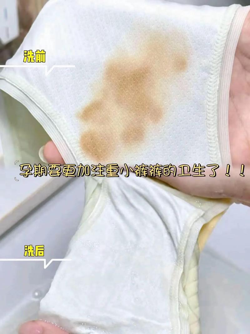 孕期内裤出现黄色分泌物是否属于正常现象?-第3张图片-郑州医学网 孕期内裤出现黄色分泌物是否属于正常现象?-第3张图片-郑州医学网