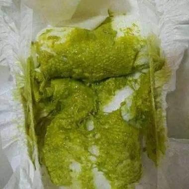 新生儿拉屎有奶瓣还发绿,是消化不良还是需要就医?-第2张图片-郑州医学网 新生儿拉屎有奶瓣还发绿,是消化不良还是需要就医?-第2张图片-郑州医学网