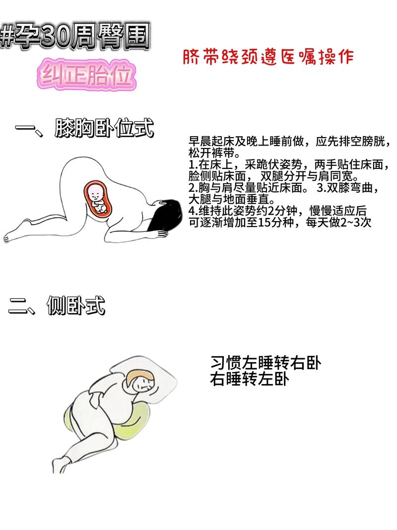 孕期胎位不正怎么办?这些方法能否帮助顺利转正?-第1张图片-郑州医学网 孕期胎位不正怎么办?这些方法能否帮助顺利转正?-第1张图片-郑州医学网
