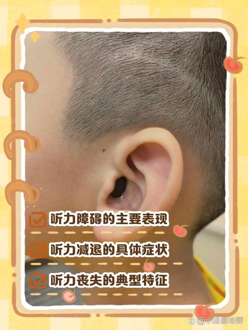 新生儿黄疸听力筛查未通过，是病理性黄疸影响还是其他原因？-第2张图片-郑州医学网