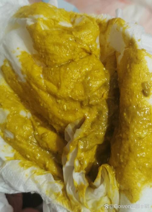 新生儿便便酸臭是正常现象吗？需要担心消化问题吗？-第1张图片-郑州医学网