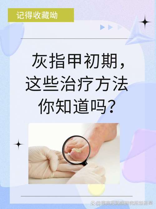 孕期灰指甲会影响胎儿健康吗?有哪些安全有效的治疗方法?-第3张图片-郑州医学网 孕期灰指甲会影响胎儿健康吗?有哪些安全有效的治疗方法?-第3张图片-郑州医学网