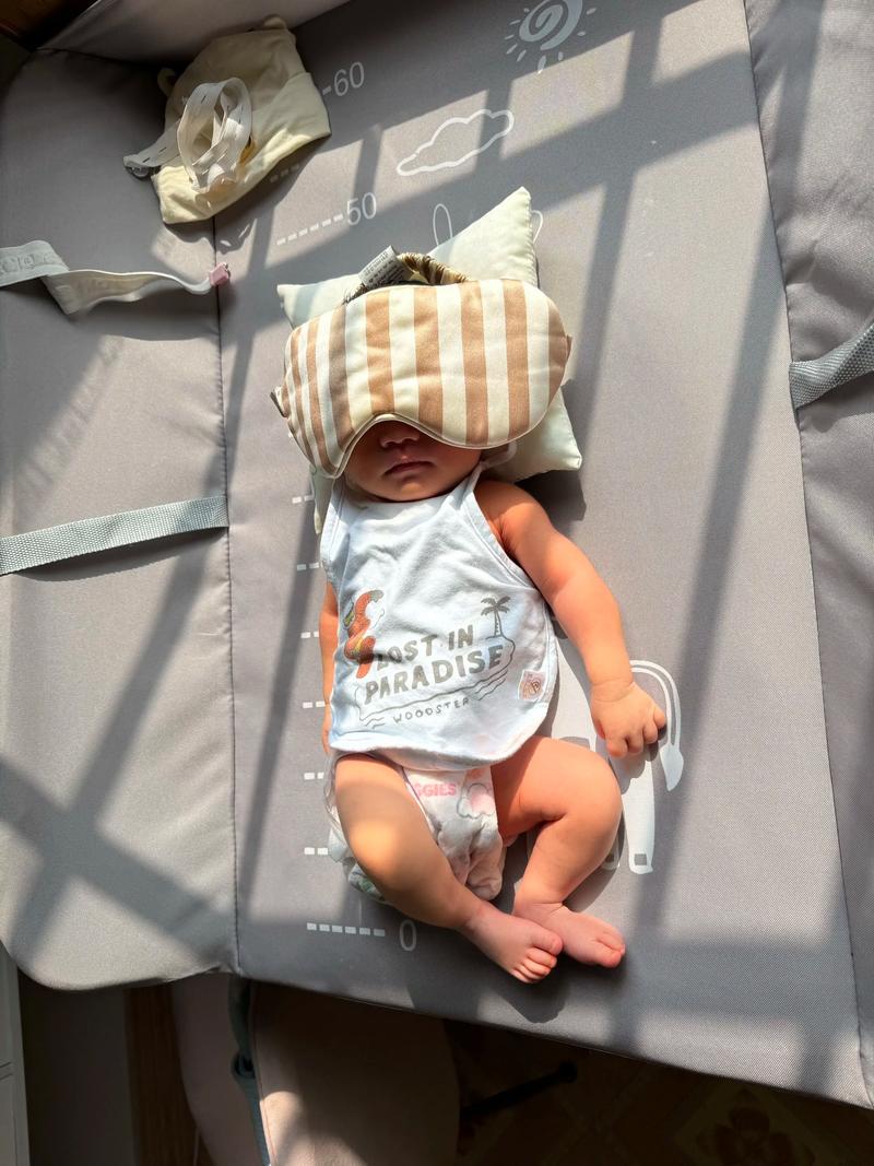 新生儿脸晒太阳真的安全吗？正确方法和注意事项有哪些？-第3张图片-郑州医学网