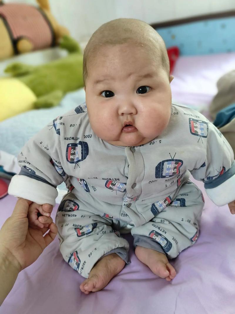 新生儿先天愚型表情有何特征？早期识别与干预的关键是什么？-第2张图片-郑州医学网