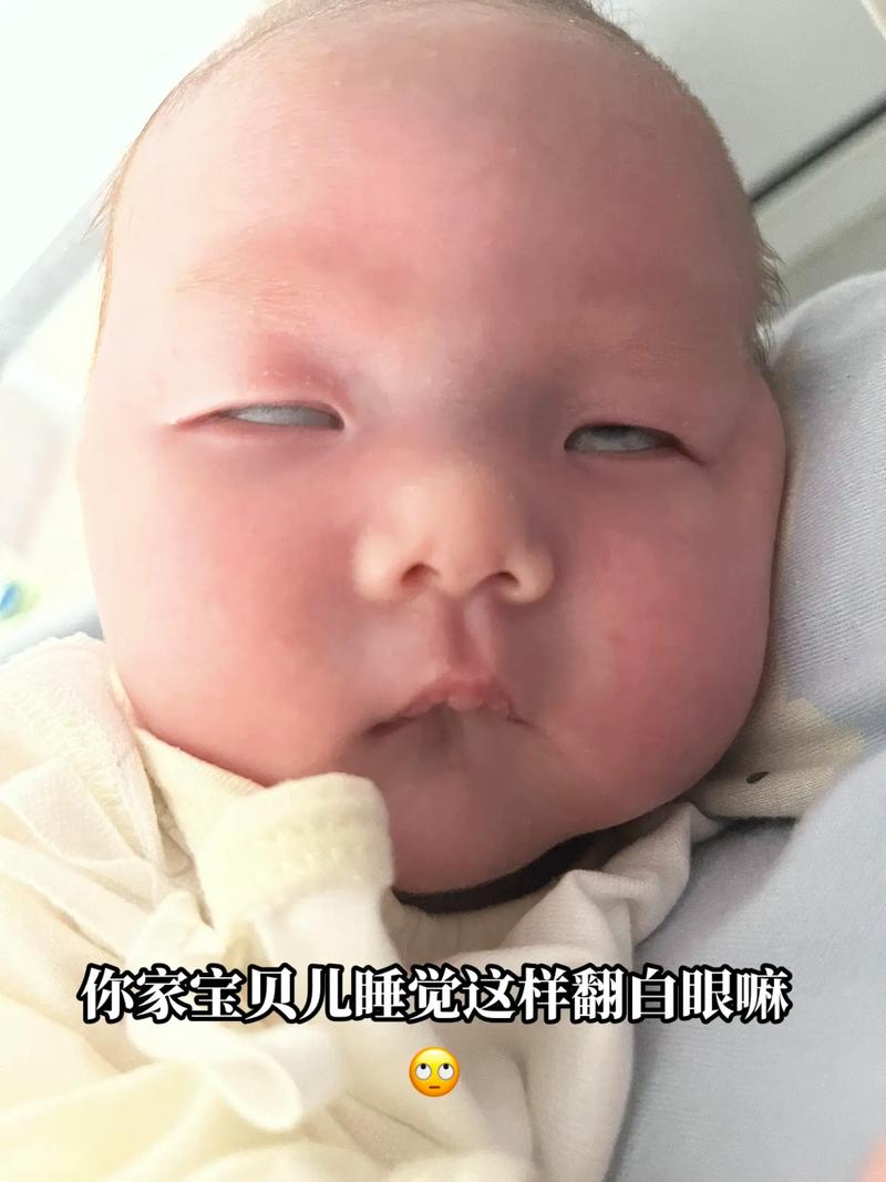 新生儿先天愚型表情有何特征？早期识别与干预的关键是什么？-第3张图片-郑州医学网
