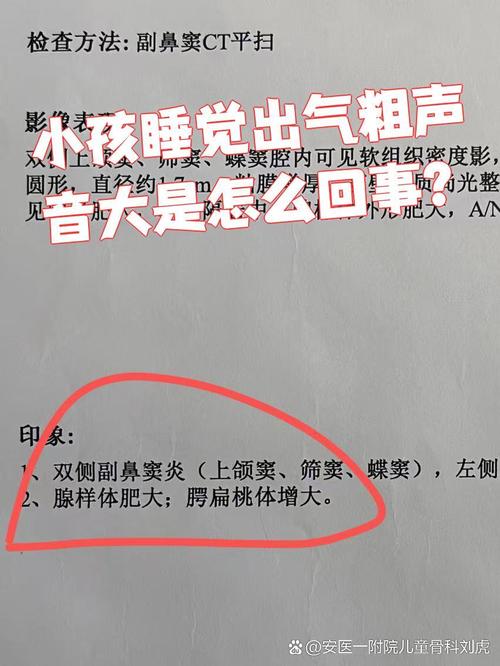 新生儿睡觉出气声很大是正常现象还是呼吸道异常？需要关注吗？-第1张图片-郑州医学网