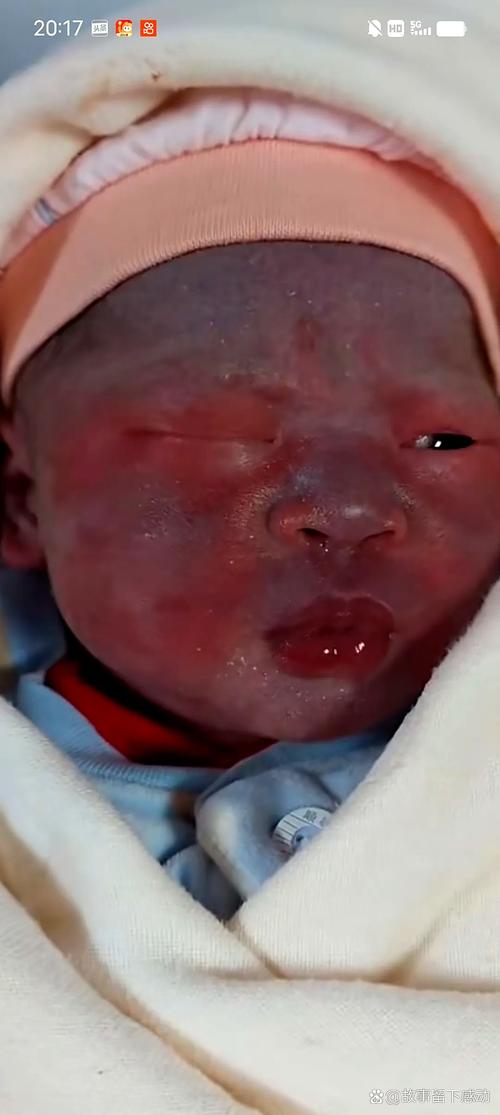 新生儿经常脸通红是正常现象还是健康预警？需关注哪些异常信号？-第1张图片-郑州医学网