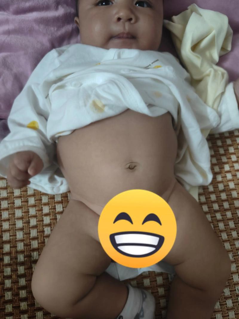 新生儿肚子鼓鼓的是正常现象还是需要警惕的健康问题？-第2张图片-郑州医学网