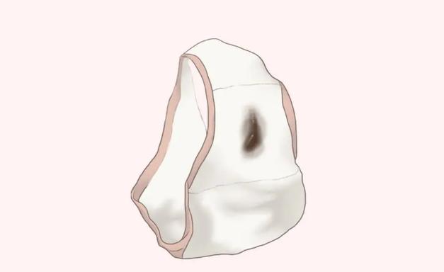 孕期出血后出现褐色分泌物，是正常生理现象还是危险信号？-第2张图片-郑州医学网