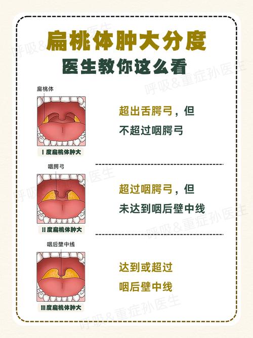 儿童扁桃体肿大必须手术吗？非手术干预如何科学选择？-第3张图片-郑州医学网