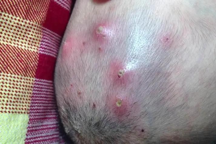 新生儿为何会感染脓包疹？病因与护理关键点解析-第2张图片-郑州医学网