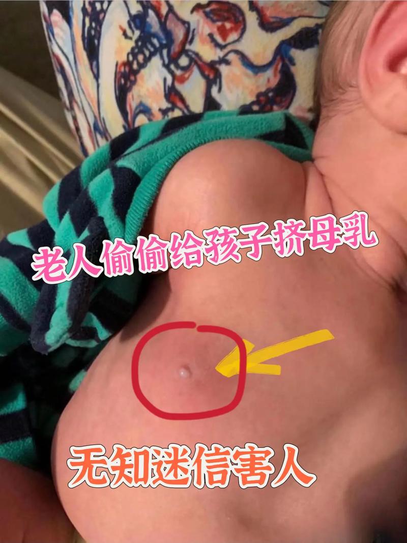 新生儿乳腺炎症状图片有哪些？如何通过图片辨别与护理？-第3张图片-郑州医学网