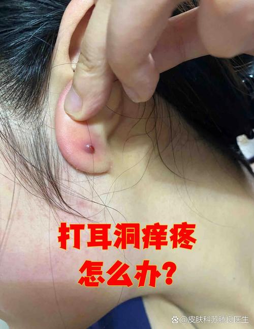 儿童头孢克肟颗粒图片有哪些?不同厂家包装和剂量图样怎么区分?-第2张图片-郑州医学网 儿童头孢克肟颗粒图片有哪些?不同厂家包装和剂量图样怎么区分?-第2张图片-郑州医学网