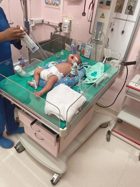 早产儿肺部感染高发,如何精准防治与降低远期风险?-第1张图片-郑州医学网 早产儿肺部感染高发,如何精准防治与降低远期风险?-第1张图片-郑州医学网