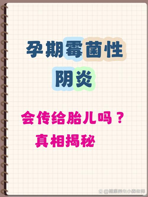 孕期念珠菌感染会不会对胎儿造成不良影响?-第2张图片-郑州医学网 孕期念珠菌感染会不会对胎儿造成不良影响?-第2张图片-郑州医学网