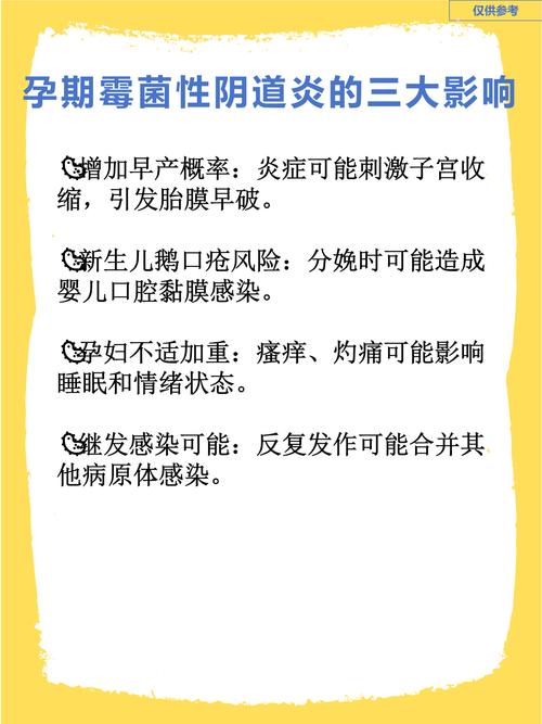 孕期念珠菌感染会不会对胎儿造成不良影响？-第3张图片-郑州医学网
