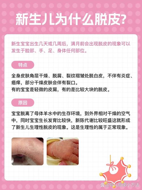 新生儿掉皮是正常生理现象还是皮肤疾病信号?-第1张图片-郑州医学网 新生儿掉皮是正常生理现象还是皮肤疾病信号?-第1张图片-郑州医学网