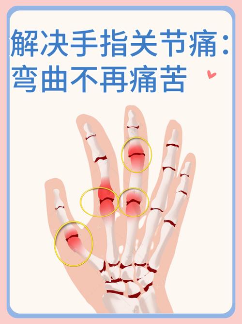 孕期手关节疼是缺钙还是激素变化？该怎么缓解才安全？-第2张图片-郑州医学网