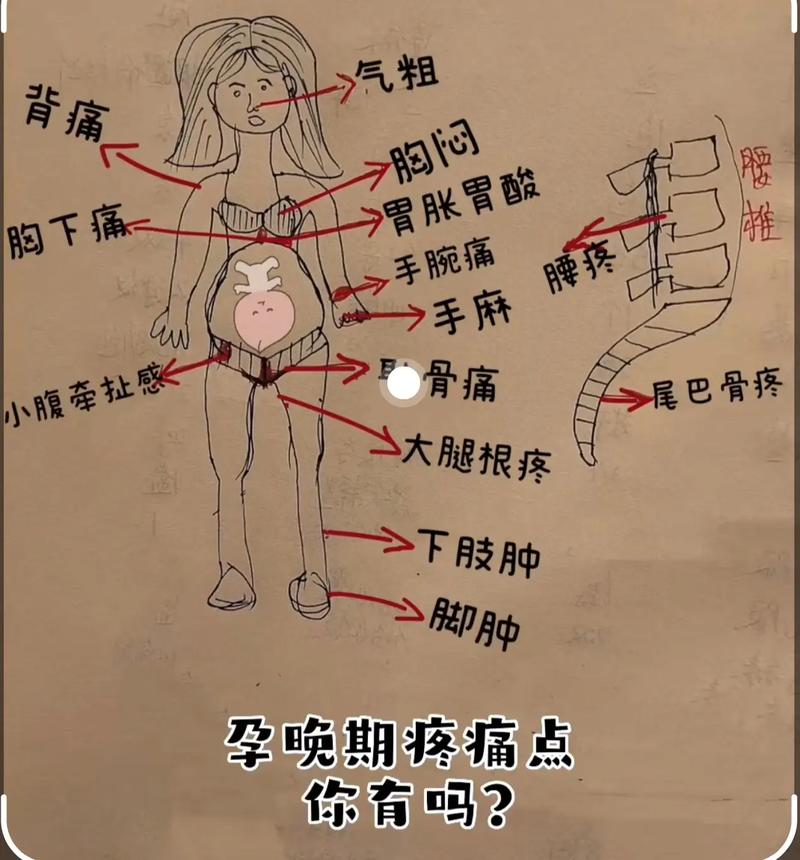 孕期胯骨疼是正常生理反应还是疾病信号？如何缓解才安全？-第1张图片-郑州医学网