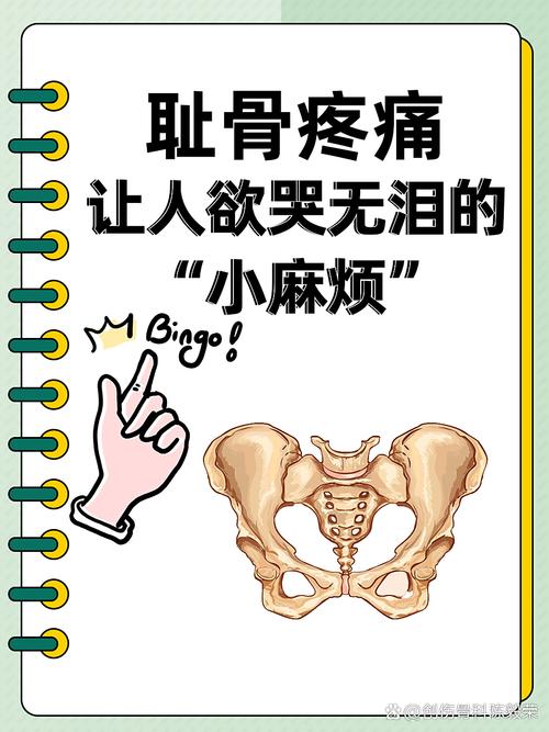 孕期胯骨疼是正常生理反应还是疾病信号？如何缓解才安全？-第2张图片-郑州医学网