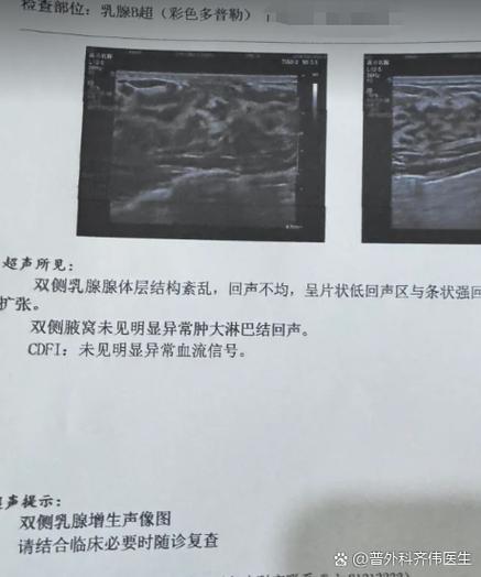 怀孕期间乳腺增生加重，会对胎儿和自身健康产生哪些影响？-第3张图片-郑州医学网