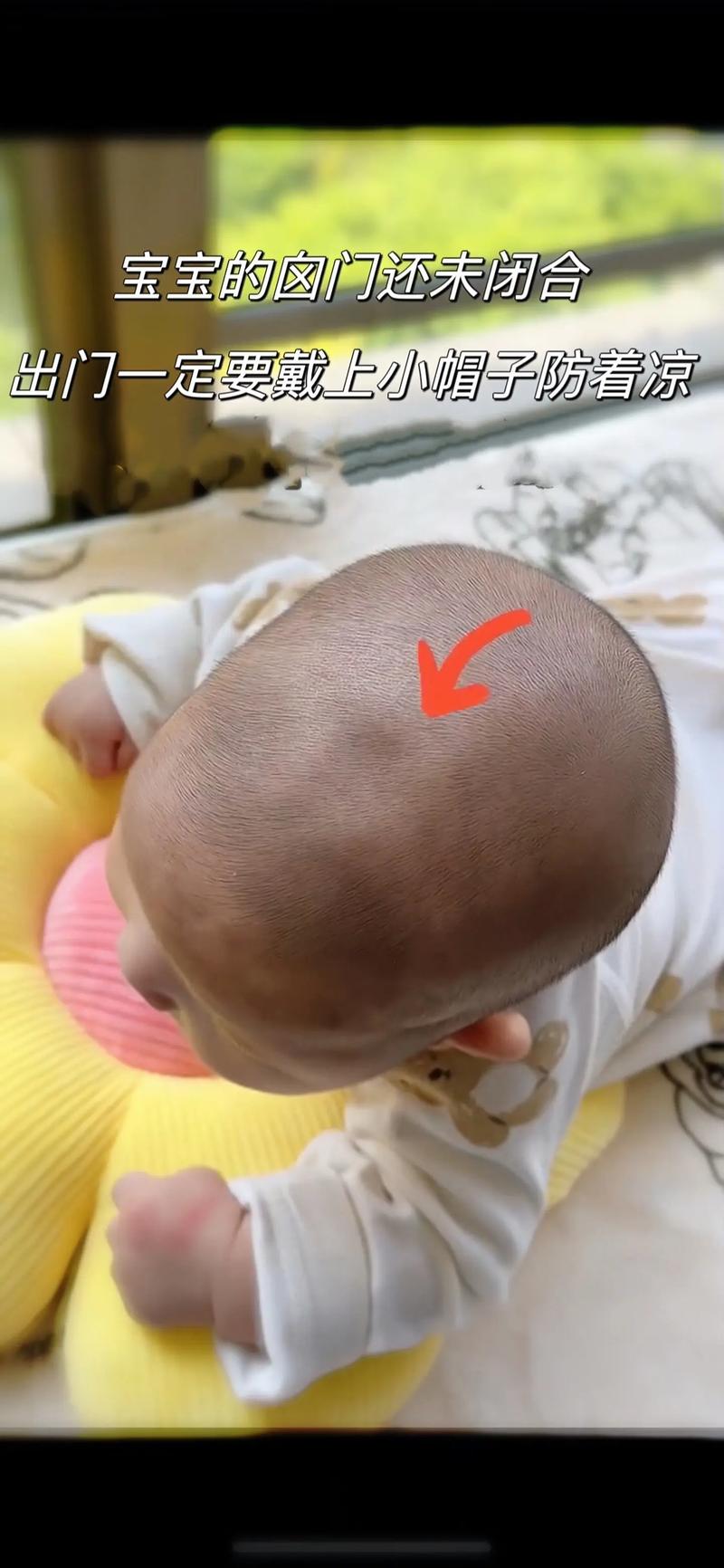 新生儿头顶头发竖起来是缺钙还是正常现象？需要干预吗？-第3张图片-郑州医学网