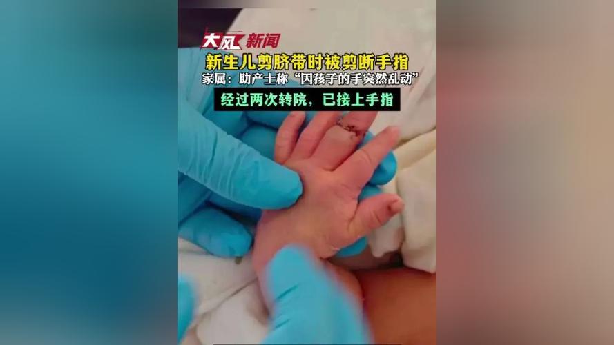 新生儿手爱在脸前乱动是正常发育信号还是需要干预的异常表现？-第1张图片-郑州医学网