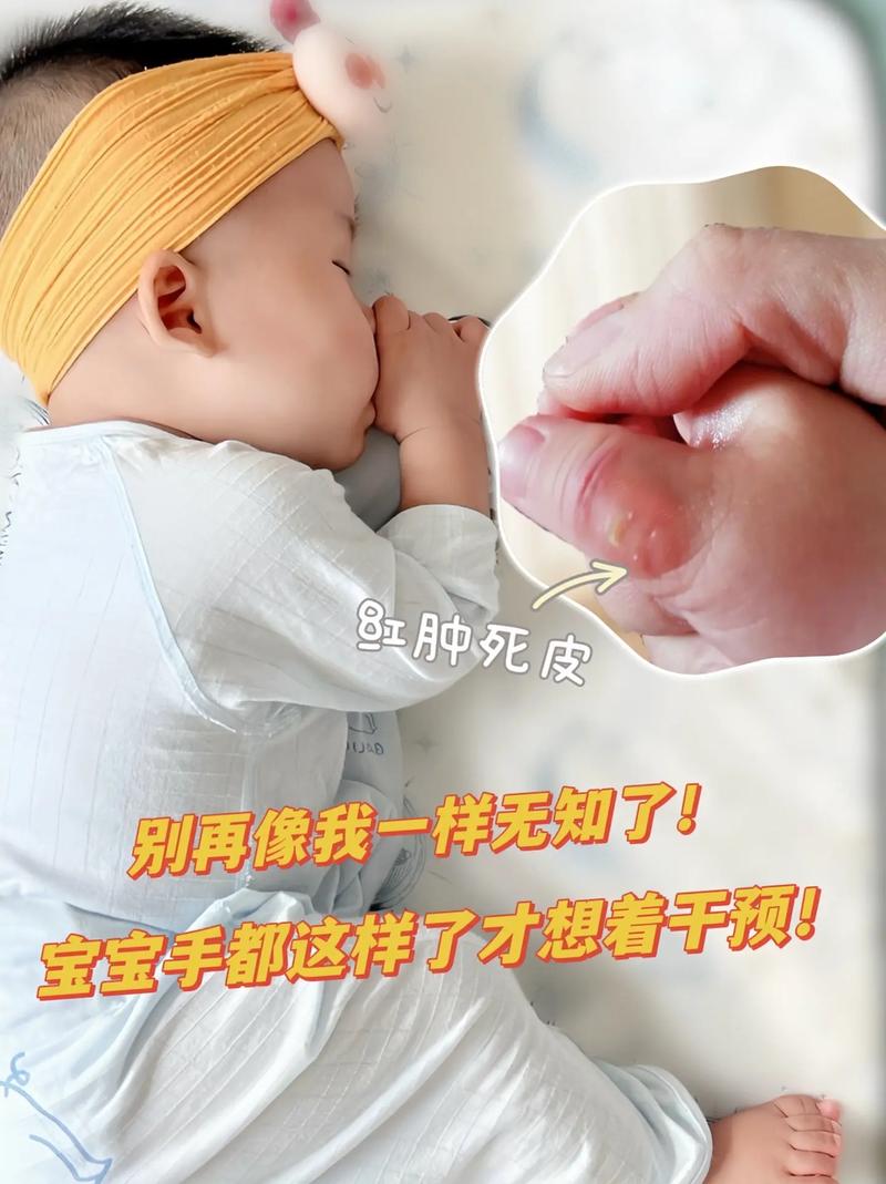 新生儿手爱在脸前乱动是正常发育信号还是需要干预的异常表现？-第2张图片-郑州医学网