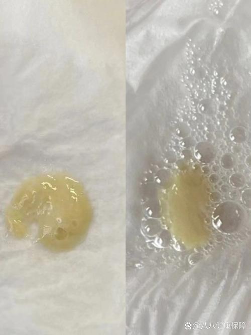 新生儿20天咳嗽有痰怎么办?新手爸妈该如何正确护理与处理?-第3张图片-郑州医学网 新生儿20天咳嗽有痰怎么办?新手爸妈该如何正确护理与处理?-第3张图片-郑州医学网