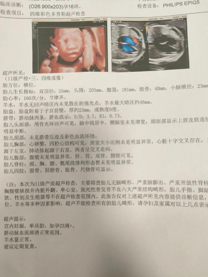 孕期大排畸检查费用差异大吗？不同地区和医院收费标准有何不同？-第1张图片-郑州医学网