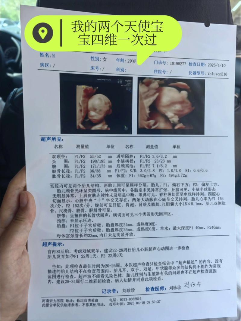 孕期大排畸检查费用差异大吗？不同地区和医院收费标准有何不同？-第3张图片-郑州医学网