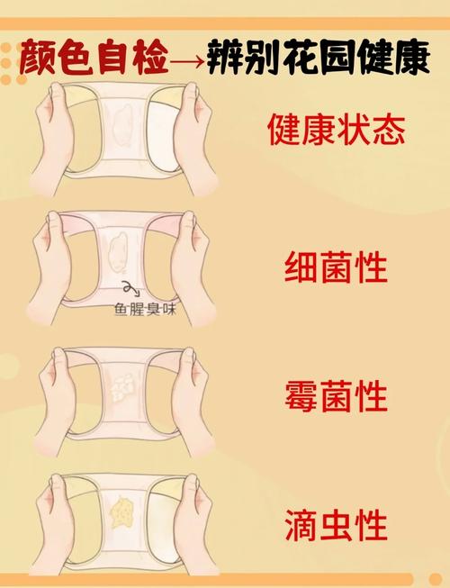 晚孕期白带增多是正常现象还是异常信号?需要警惕哪些疾病风险?-第1张图片-郑州医学网 晚孕期白带增多是正常现象还是异常信号?需要警惕哪些疾病风险?-第1张图片-郑州医学网
