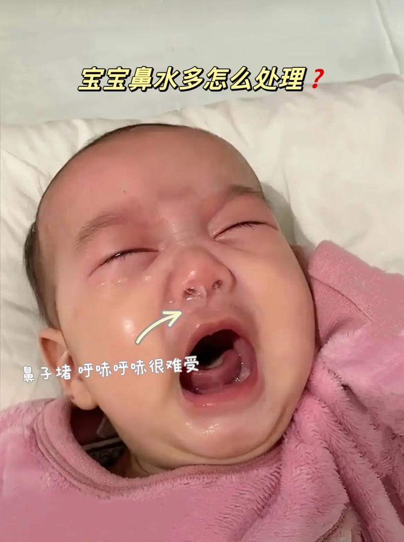 新生儿睡觉鼻子像有痰是正常现象吗？需要担心吗？-第1张图片-郑州医学网