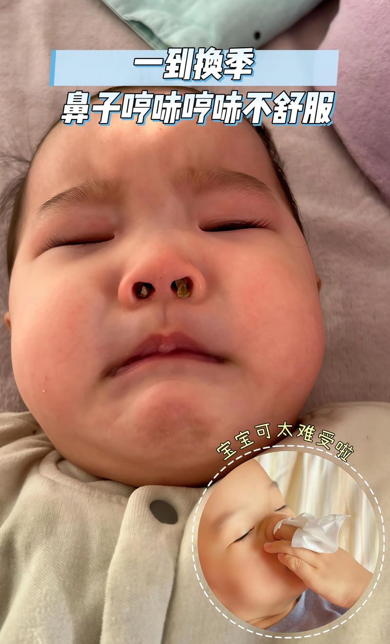 新生儿睡觉鼻子像有痰是正常现象吗？需要担心吗？-第2张图片-郑州医学网