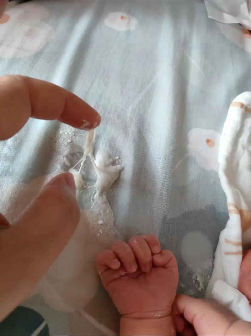 新生儿睡觉鼻子像有痰是正常现象吗？需要担心吗？-第3张图片-郑州医学网