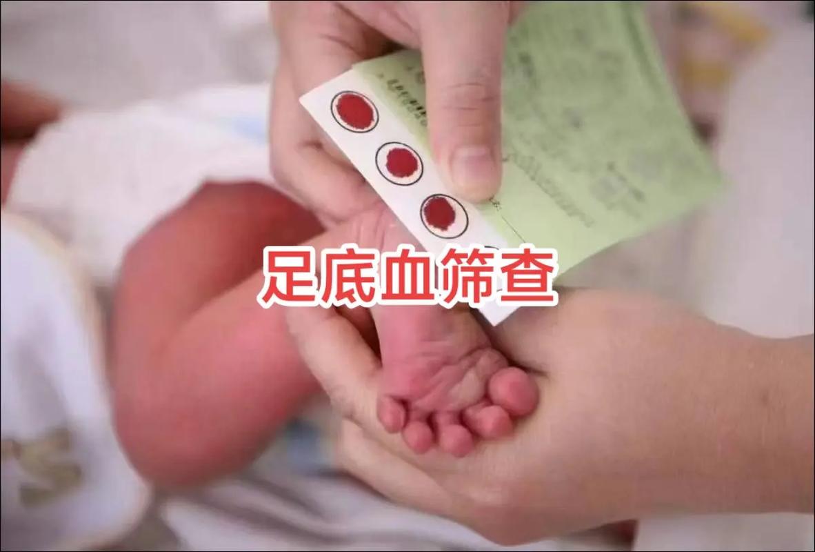 新生儿足跟血苯丙酮高是遗传病吗？需要如何干预治疗？-第1张图片-郑州医学网