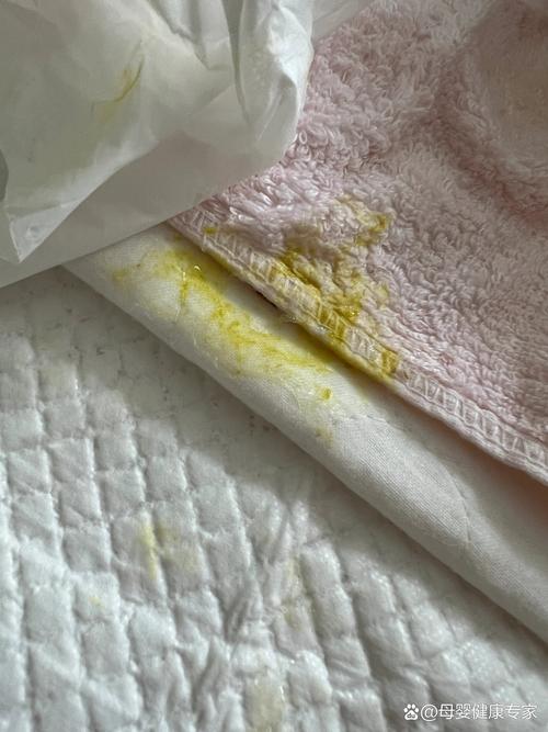 新生儿吐奶出现黏状物是正常现象还是疾病信号?附图片解析。-第1张图片-郑州医学网 新生儿吐奶出现黏状物是正常现象还是疾病信号?附图片解析。-第1张图片-郑州医学网