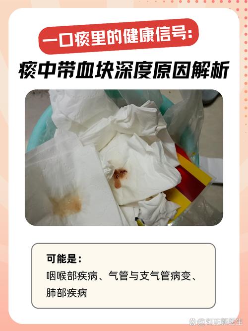 孕期痰中带血是身体发出的危险信号吗?需警惕哪些孕期疾病隐患?-第1张图片-郑州医学网 孕期痰中带血是身体发出的危险信号吗?需警惕哪些孕期疾病隐患?-第1张图片-郑州医学网