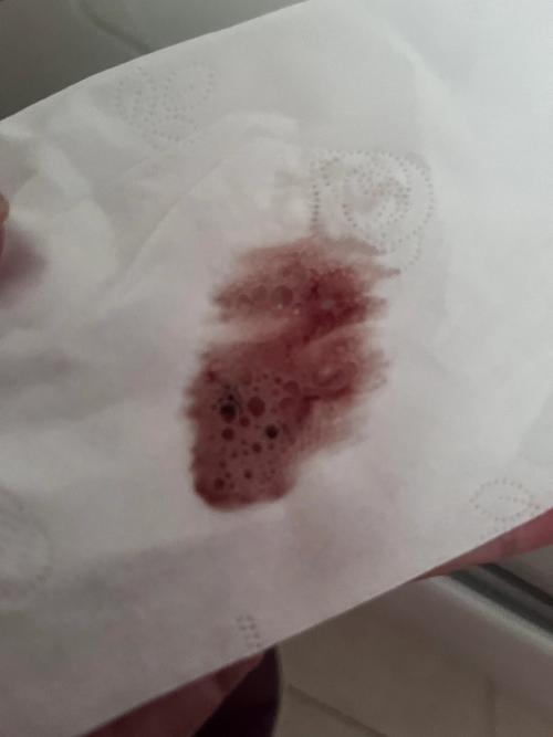 孕期痰中带血是身体发出的危险信号吗？需警惕哪些孕期疾病隐患？-第3张图片-郑州医学网