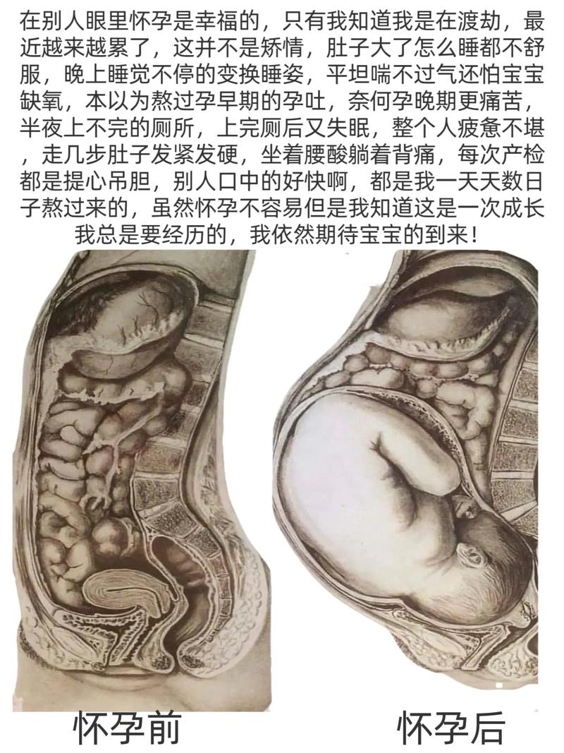 孕期下面有坨肉堵住是何原因?会对分娩造成影响吗?-第3张图片-郑州医学网 孕期下面有坨肉堵住是何原因?会对分娩造成影响吗?-第3张图片-郑州医学网