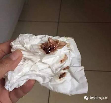 孕期褐色分泌物是正常生理现象还是危险信号？需要警惕哪些异常情况？-第1张图片-郑州医学网